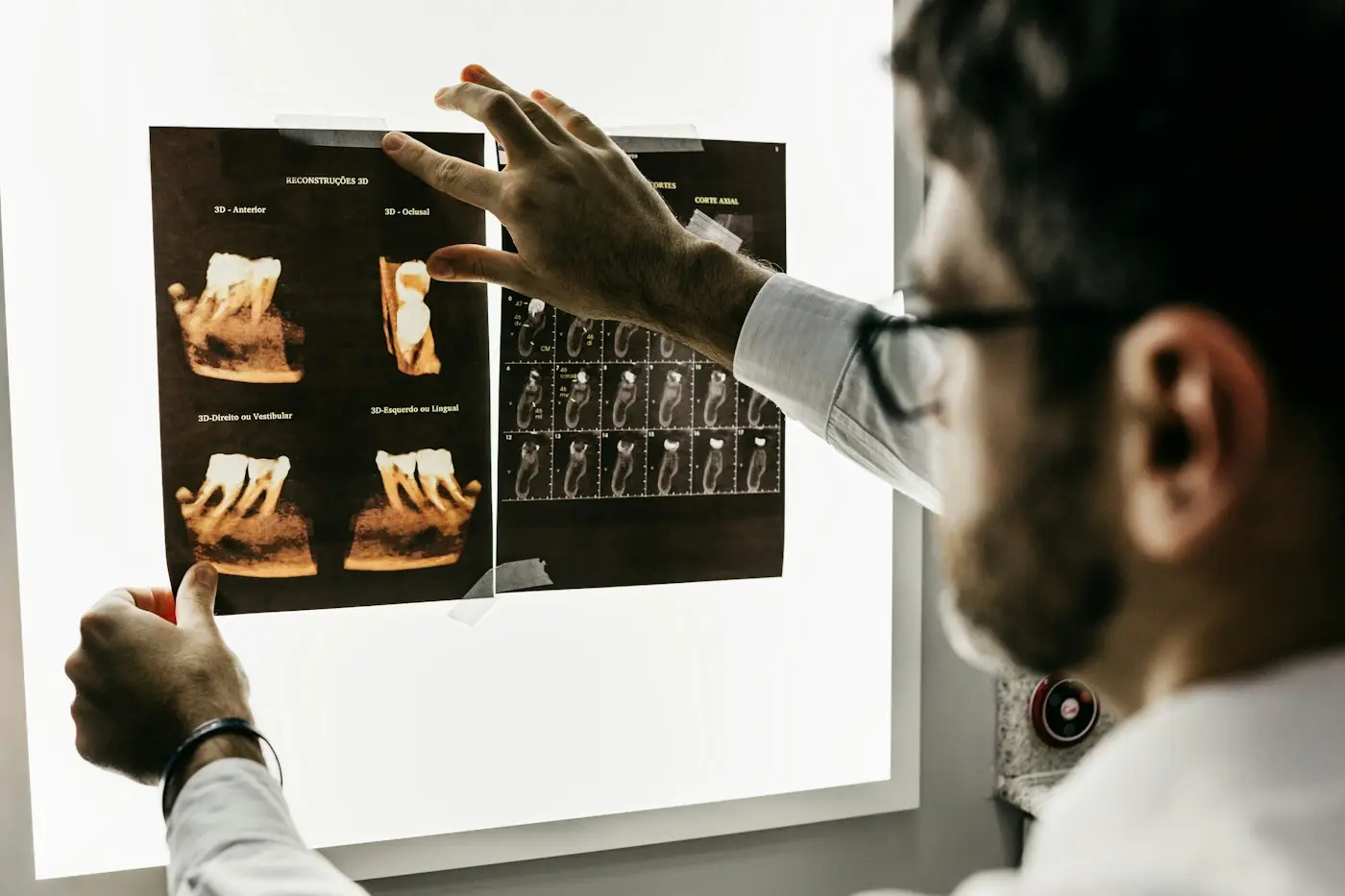 Dentista revisando radiografías dentales en una caja de luz
